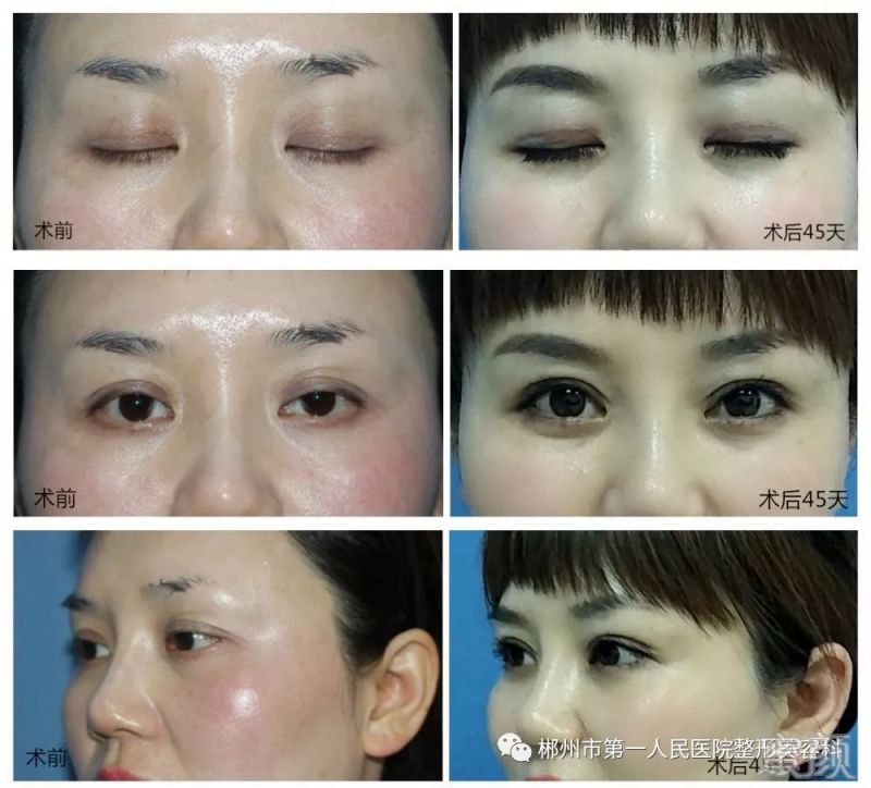 https://img.miyanlife.com/mnt/timg/191223/19115J2I-5.jpg