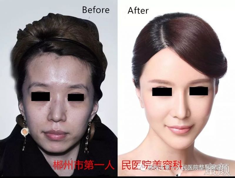 https://img.miyanlife.com/mnt/timg/191223/19115TN8-6.jpg