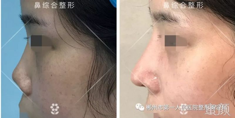 https://img.miyanlife.com/mnt/timg/191223/1912005345-8.jpg