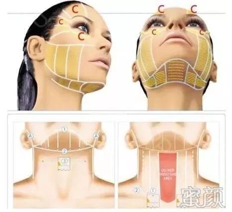 https://img.miyanlife.com/mnt/timg/191223/1924263130-3.jpg