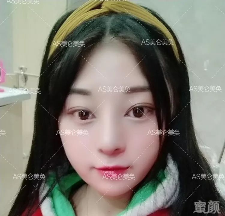 案例图片