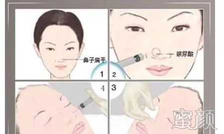 https://img.miyanlife.com/mnt/timg/191223/1941592b1-4.jpg