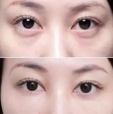 https://img.miyanlife.com/mnt/timg/191223/1F41LV9-4.jpg
