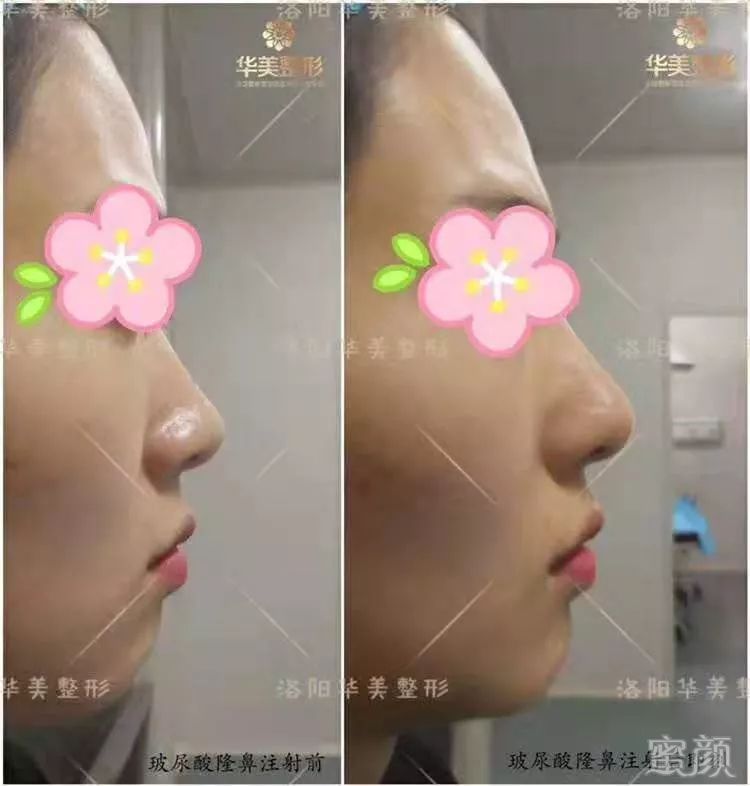 https://img.miyanlife.com/mnt/timg/191223/1F41V302-5.jpg