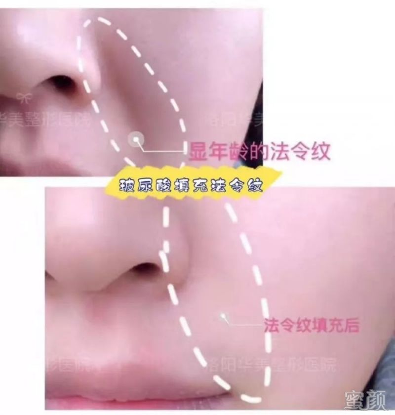 https://img.miyanlife.com/mnt/timg/191223/1F41W1A-6.jpg
