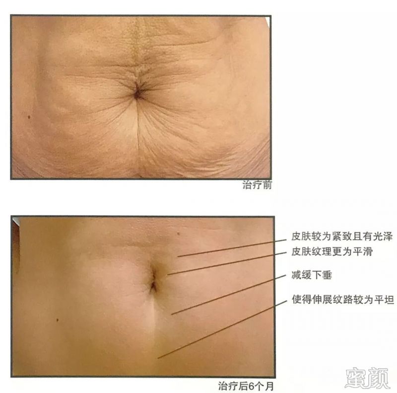 https://img.miyanlife.com/mnt/timg/191223/1H11A508-8.jpg