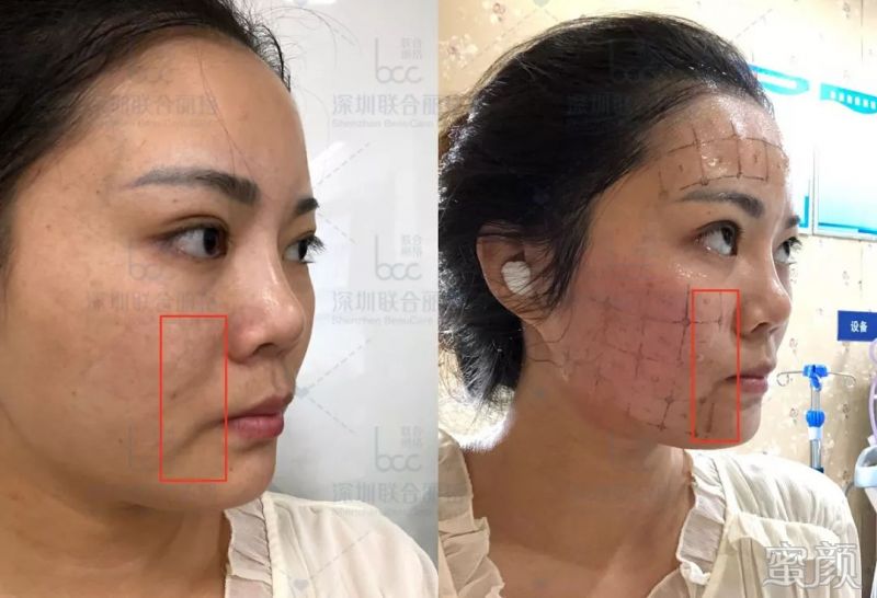 https://img.miyanlife.com/mnt/timg/191223/1H51BS1-6.jpg