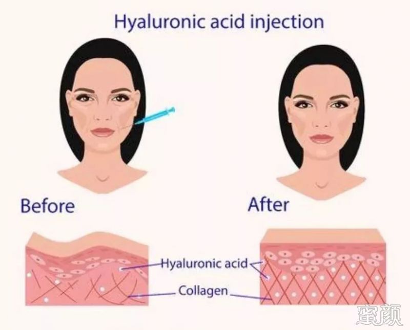 https://img.miyanlife.com/mnt/timg/191223/1H9402S0-10.jpg