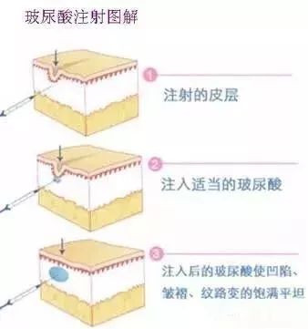 https://img.miyanlife.com/mnt/timg/191223/1H94151K-11.jpg