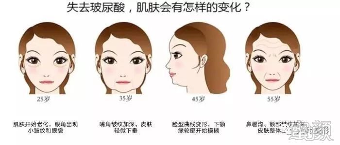 https://img.miyanlife.com/mnt/timg/191223/1I3011H8-0.jpg