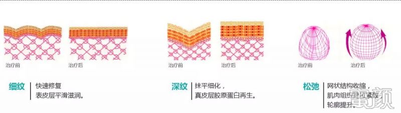https://img.miyanlife.com/mnt/timg/191223/1J1591364-9.jpg