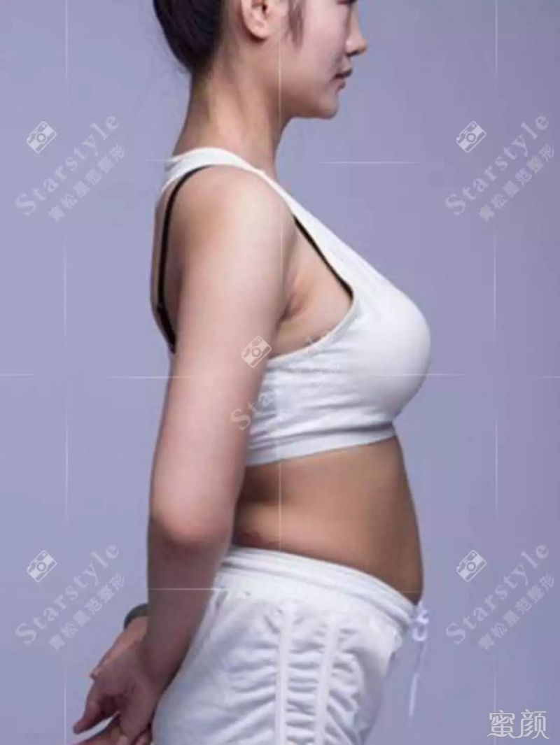 https://img.miyanlife.com/mnt/timg/191223/2055331459-10.jpg