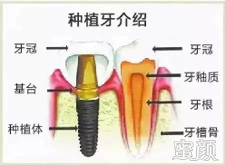 案例图片