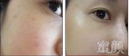 https://img.miyanlife.com/mnt/timg/191224/12553141U-4.jpg