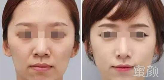 https://img.miyanlife.com/mnt/timg/191224/12553220Y-7.jpg