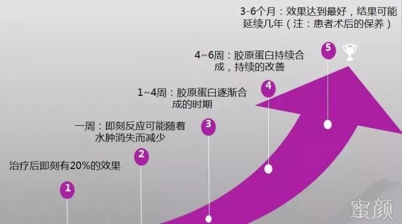 https://img.miyanlife.com/mnt/timg/191224/133S95113-5.jpg