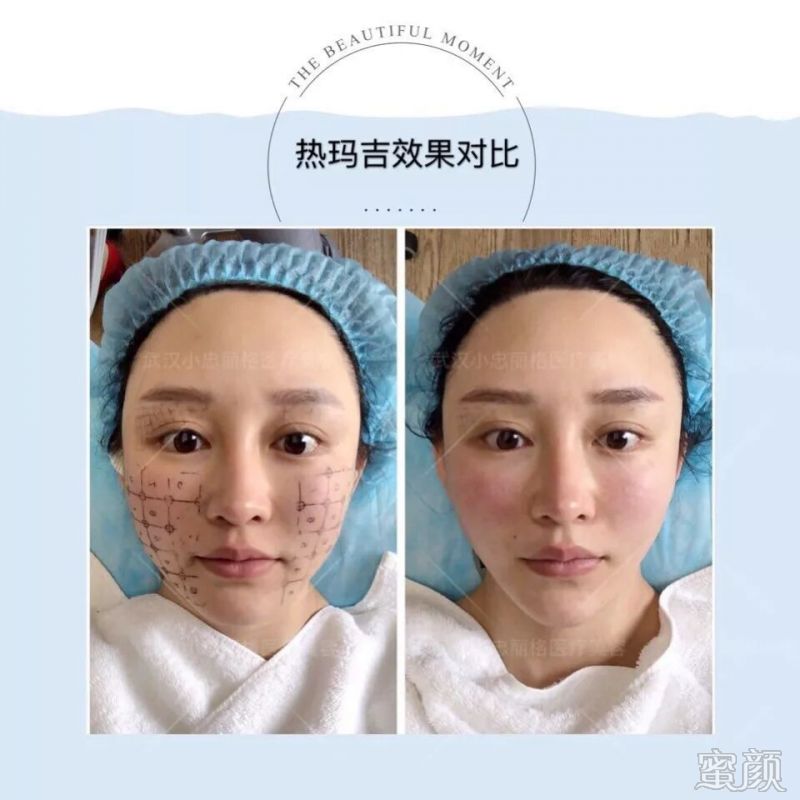 https://img.miyanlife.com/mnt/timg/191224/133SRC5-4.jpg