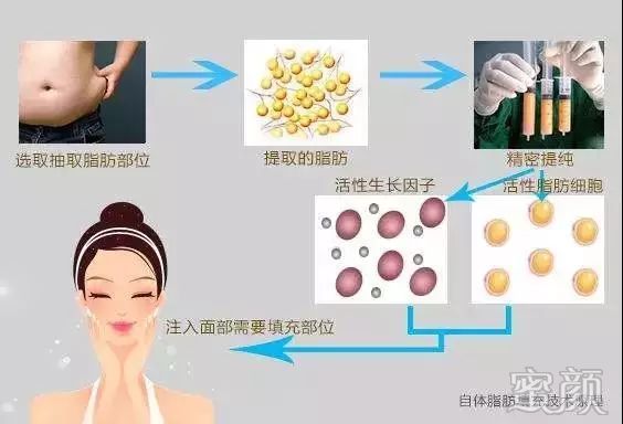 https://img.miyanlife.com/mnt/timg/191224/15202I292-1.jpg