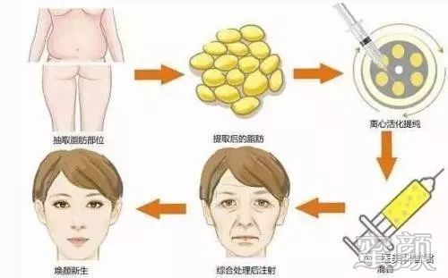 https://img.miyanlife.com/mnt/timg/191224/15352T112-6.jpg