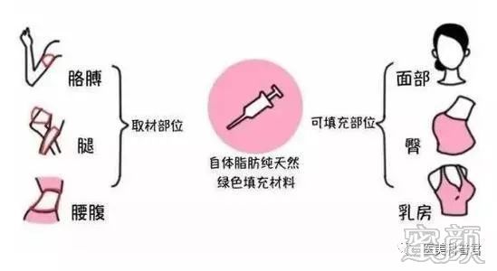https://img.miyanlife.com/mnt/timg/191224/15352a033-7.jpg