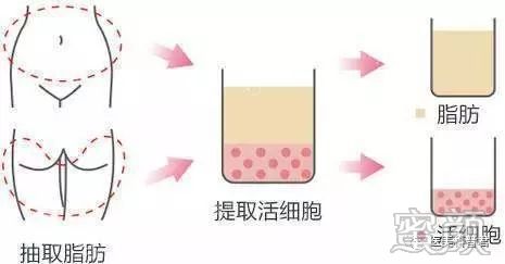 https://img.miyanlife.com/mnt/timg/191224/15353062b-9.jpg