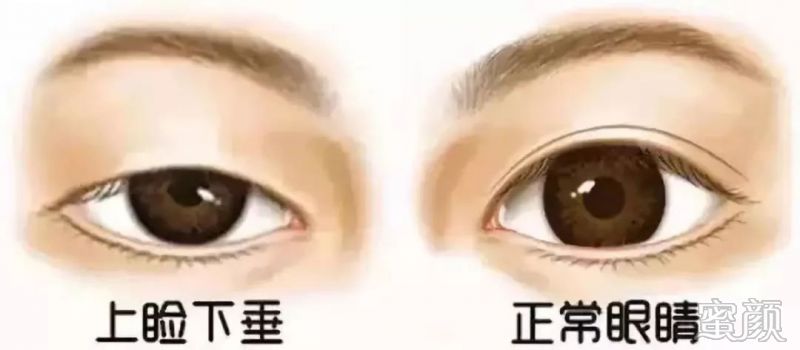https://img.miyanlife.com/mnt/timg/191224/15520525V-5.jpg