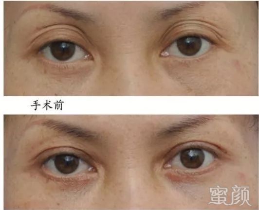 https://img.miyanlife.com/mnt/timg/191224/1602253U9-9.jpg