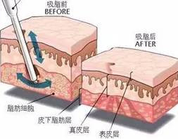https://img.miyanlife.com/mnt/timg/191224/1612152H7-7.jpg