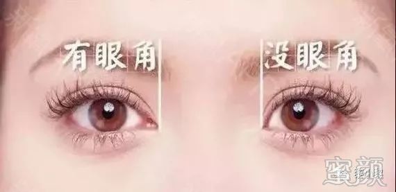 https://img.miyanlife.com/mnt/timg/191224/1613136407-3.jpg
