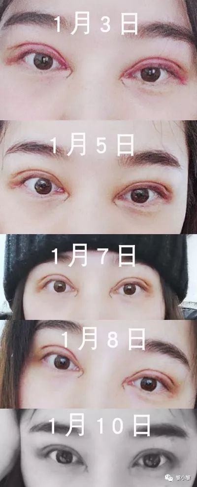 https://img.miyanlife.com/mnt/timg/191224/161324F22-11.jpg
