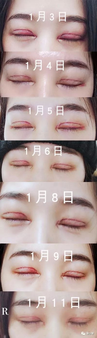 https://img.miyanlife.com/mnt/timg/191224/1613256044-12.jpg