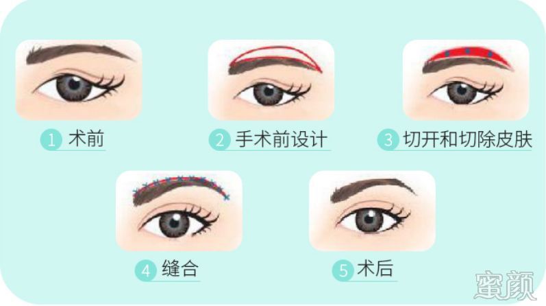 https://img.miyanlife.com/mnt/timg/191224/1A3391B3-6.jpg