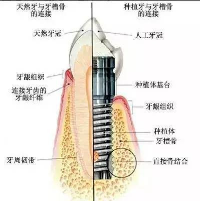 案例图片