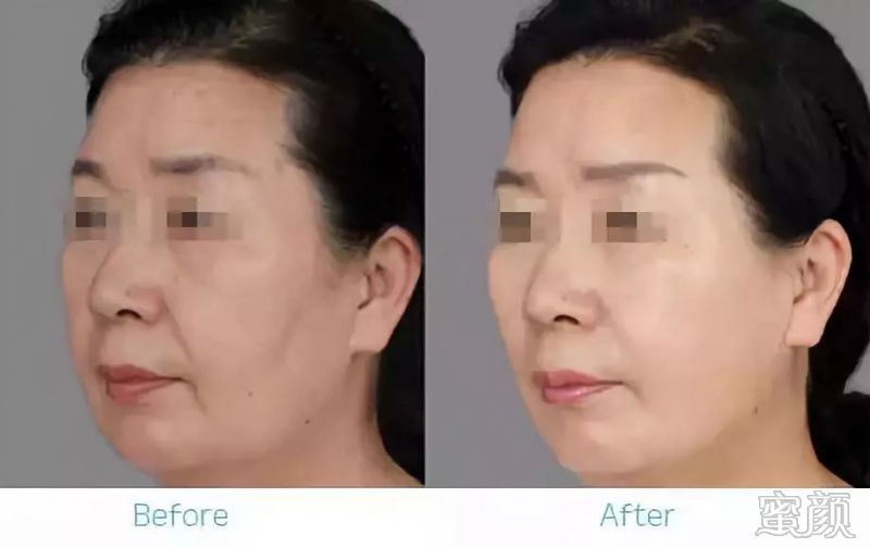 https://img.miyanlife.com/mnt/timg/191224/1F42VK4-4.jpg