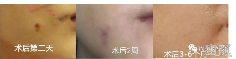 https://img.miyanlife.com/mnt/timg/191225/1514114395-3.jpg