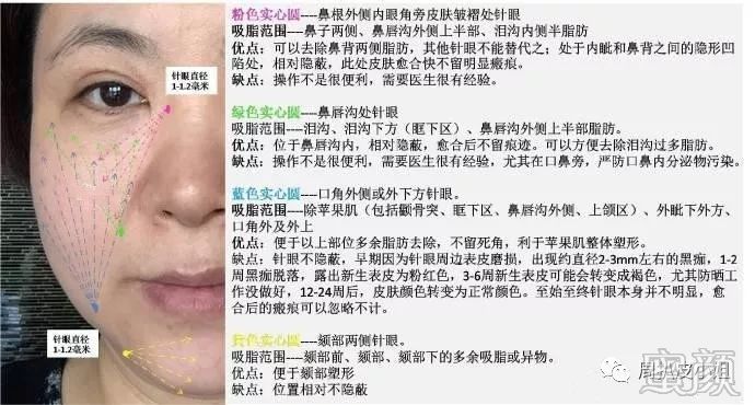 https://img.miyanlife.com/mnt/timg/191225/1514115521-2.jpg