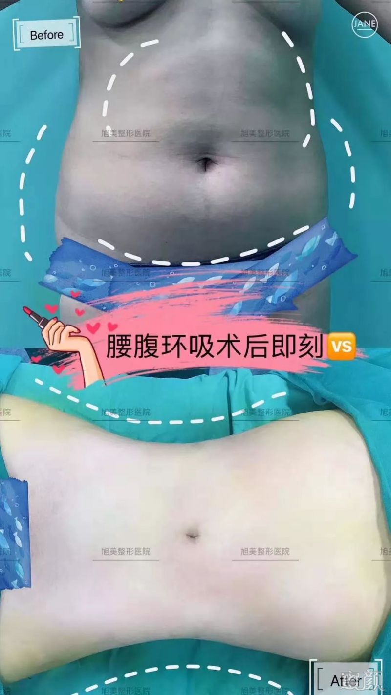 https://img.miyanlife.com/mnt/timg/191225/1535402945-2.jpg