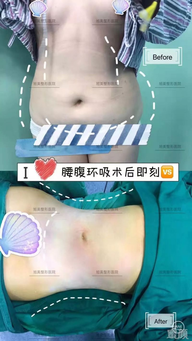 https://img.miyanlife.com/mnt/timg/191225/1535421108-4.jpg