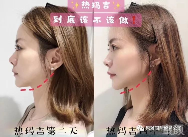 https://img.miyanlife.com/mnt/timg/191225/1G9562O3-4.jpg