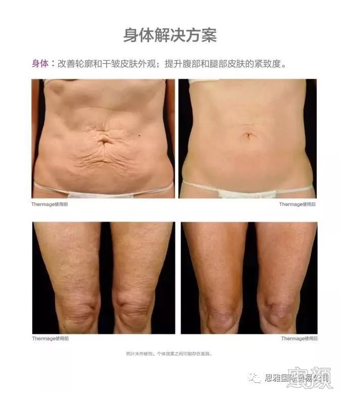 https://img.miyanlife.com/mnt/timg/191225/1G95M919-6.jpg