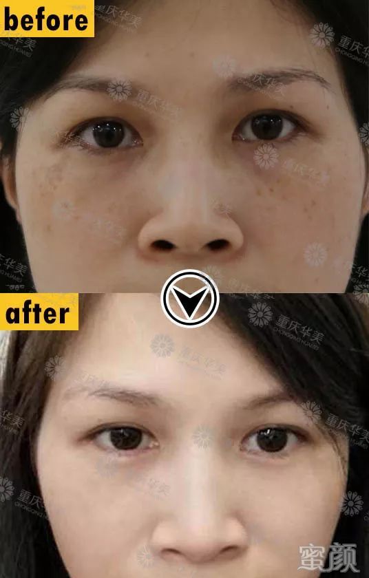 https://img.miyanlife.com/mnt/timg/191225/1H61BI0-10.jpg