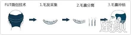 案例图片