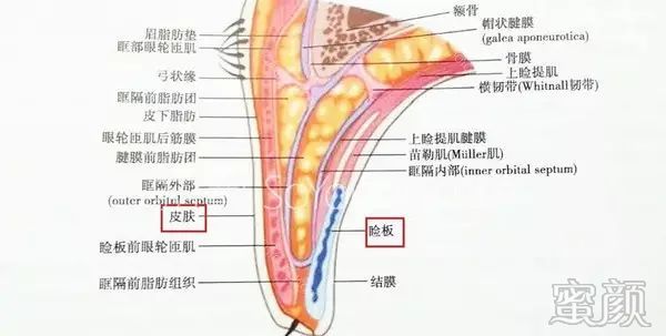 案例图片