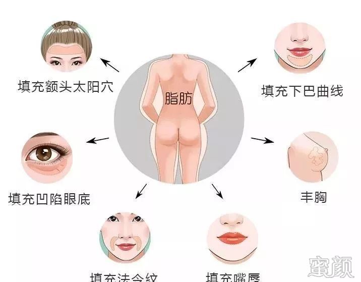 https://img.miyanlife.com/mnt/timg/191226/1402026231-1.jpg