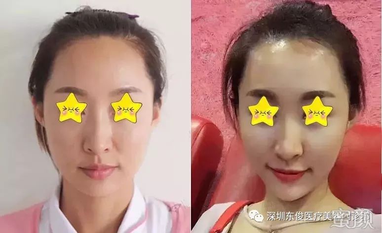 https://img.miyanlife.com/mnt/timg/191226/1402035E7-3.jpg