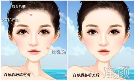 https://img.miyanlife.com/mnt/timg/191226/141111LM-3.jpg