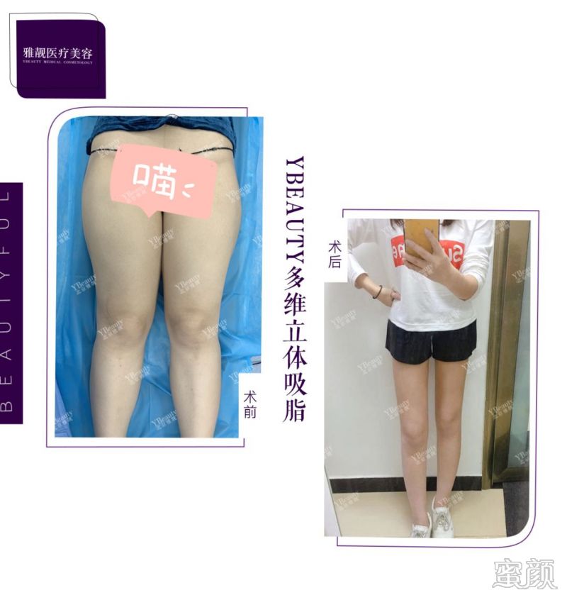 https://img.miyanlife.com/mnt/timg/191226/142SS420-6.jpg