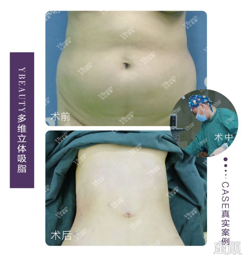 https://img.miyanlife.com/mnt/timg/191226/142T12563-9.jpg