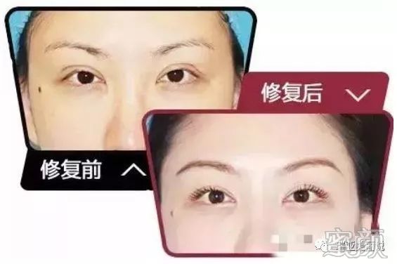 https://img.miyanlife.com/mnt/timg/191226/15201052R-4.jpg