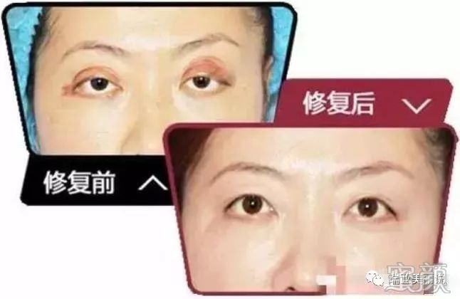 https://img.miyanlife.com/mnt/timg/191226/15201121W-6.jpg